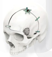 jeil_skull21
